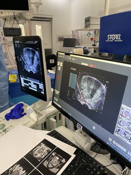 NanoKnife treatment planning workstation